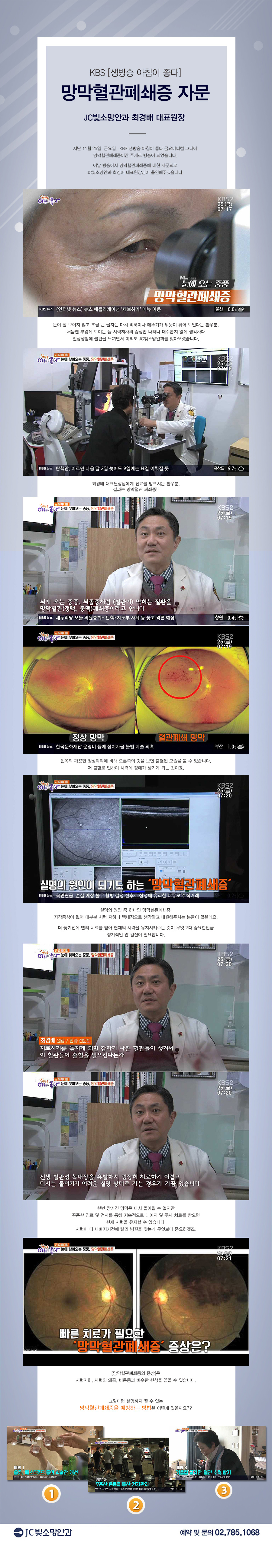 망막혈관폐쇄관련_TV.jpg