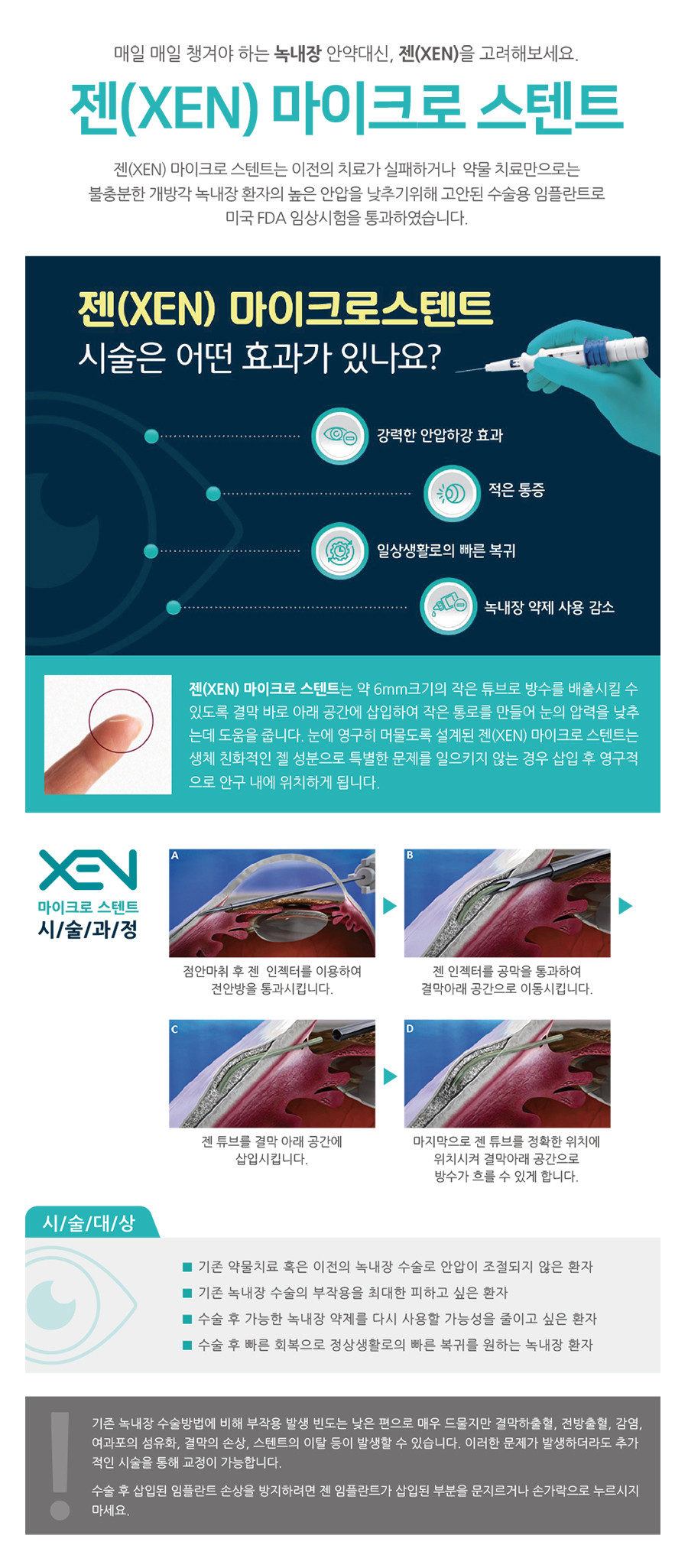 xen micro stent.jpg